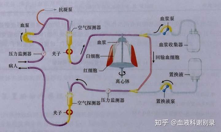什么是血浆置换?与透析有什么区别?