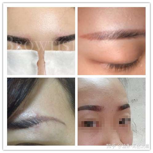 纹眉失败洗眉一种怎样的体验?