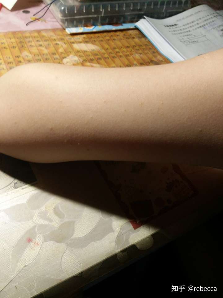 脸上皮肤像鸡皮干痒疼(脸上皮肤像鸡皮干痒疼怎么办) 脸上皮肤像鸡皮干痒疼(脸上皮肤像鸡皮干痒疼怎么办)