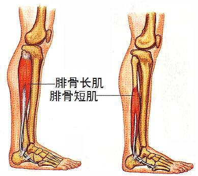 為什麼跑步小腿會痛脛骨內側應力綜合徵完全康復方案