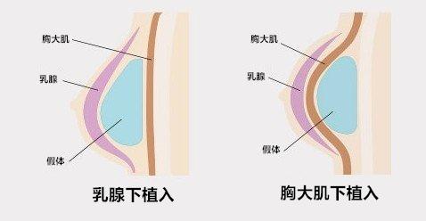 减震内衣推荐_内衣美女(3)