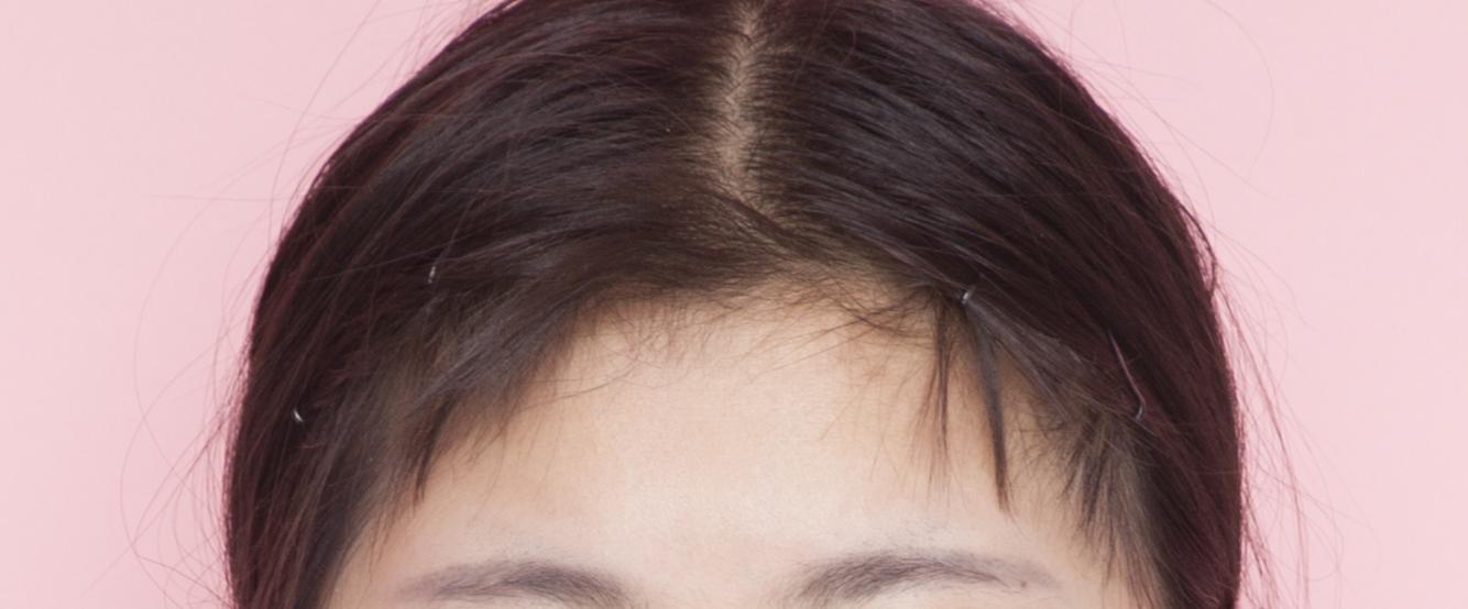 发际线太低,想自己往上刮一点,再用遮瑕粉一类