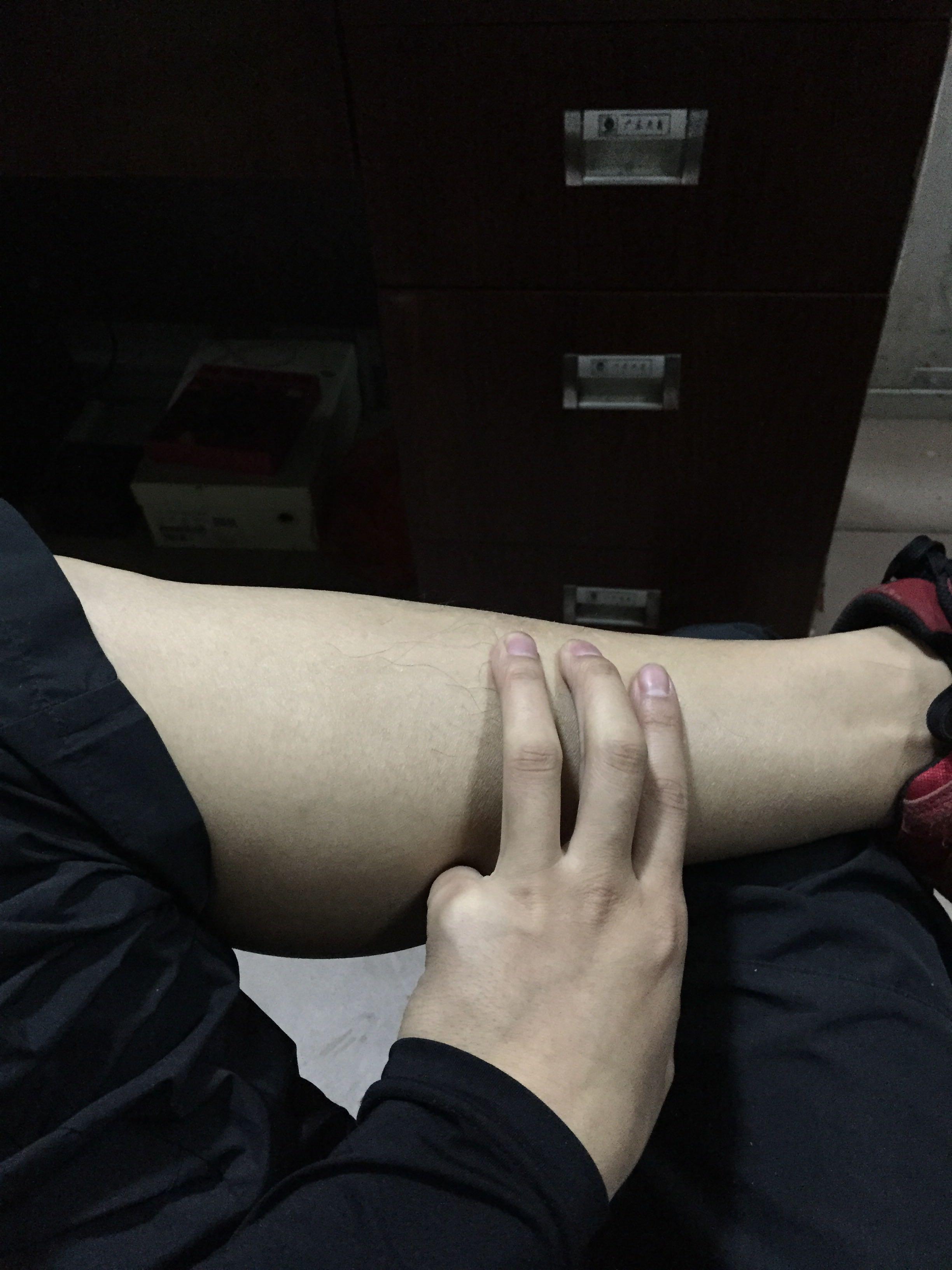 用手指轻压小腿内侧有痛感?