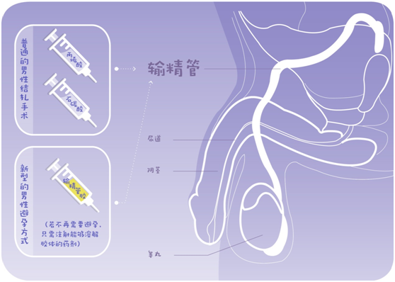 阴囊注射水玩法图片