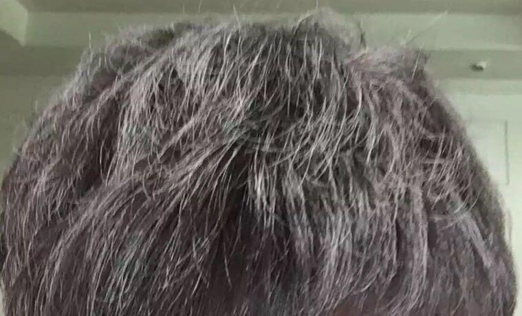 一般多久开始有白头发 8f9167f07c175d3624a8d57107fa53b5_r.jpg