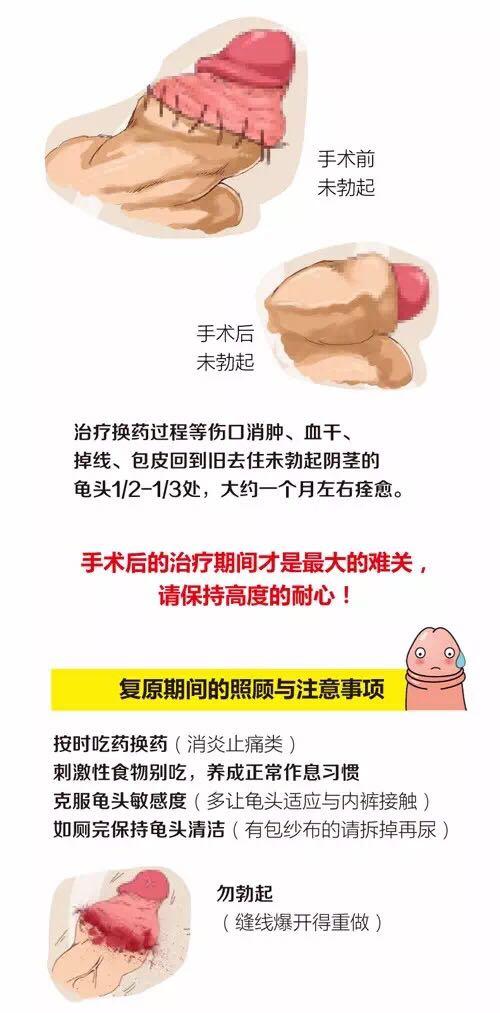 包皮术后多久能拆线这样做恢复快 每日头条