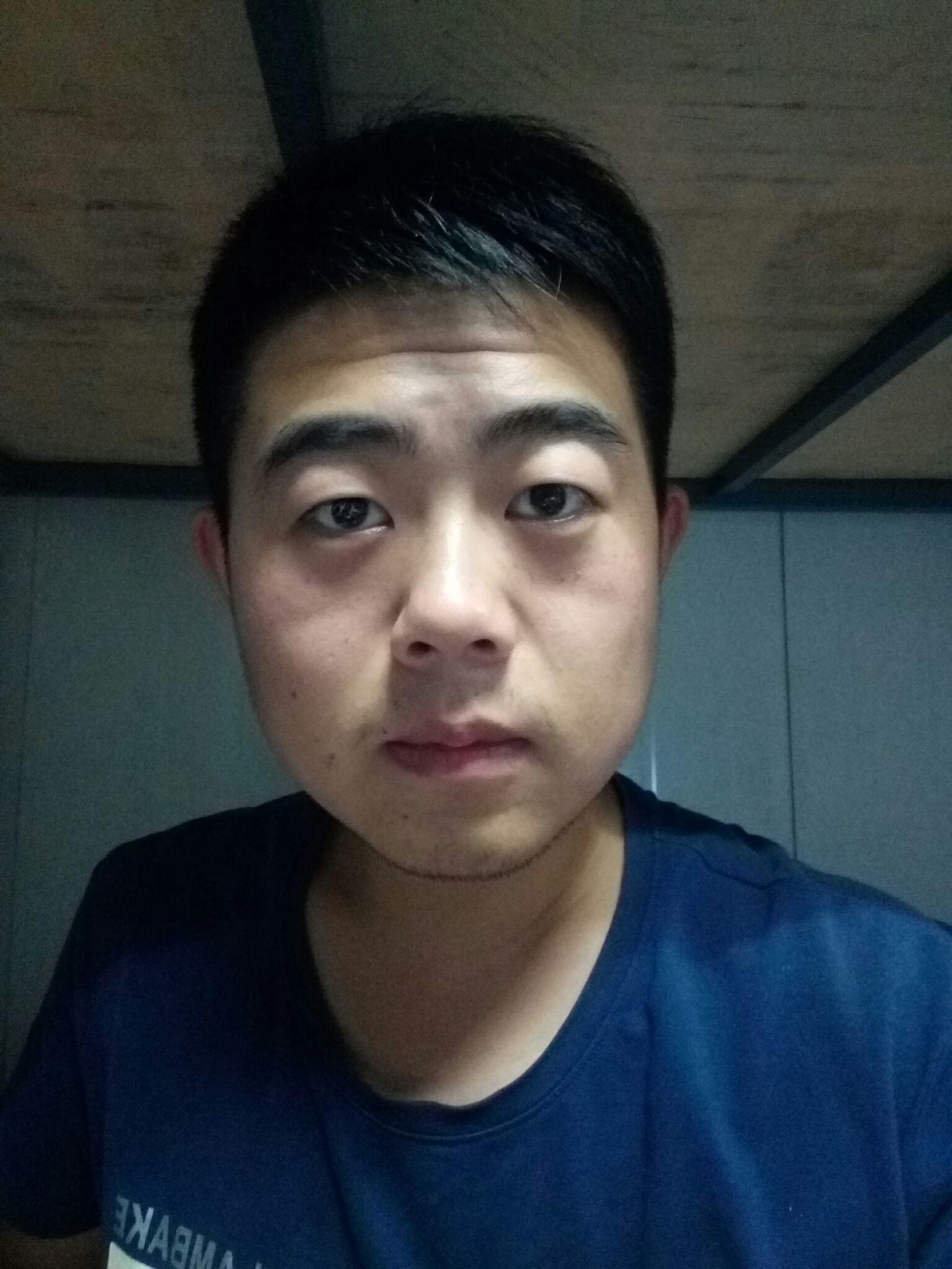 减肥之后为什么脸没瘦下来? - 健身与减脂