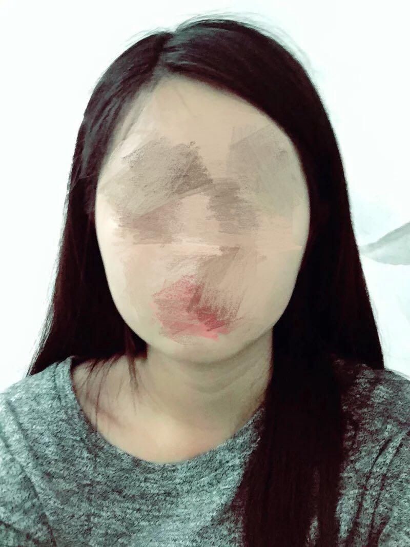 怎样矫正大小脸?