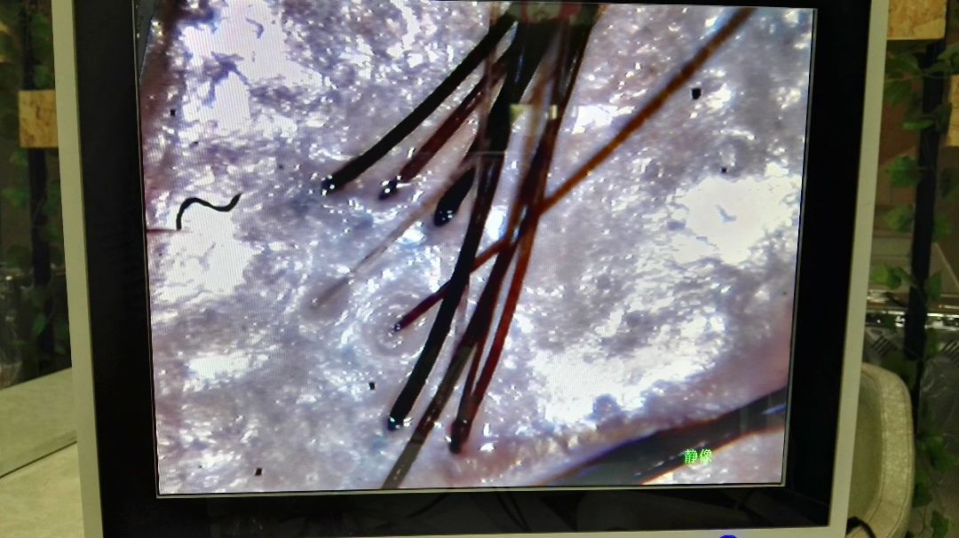 <em>头发</em>稀疏应该听信谁的话? - <em>头发护理 - 知乎</em>