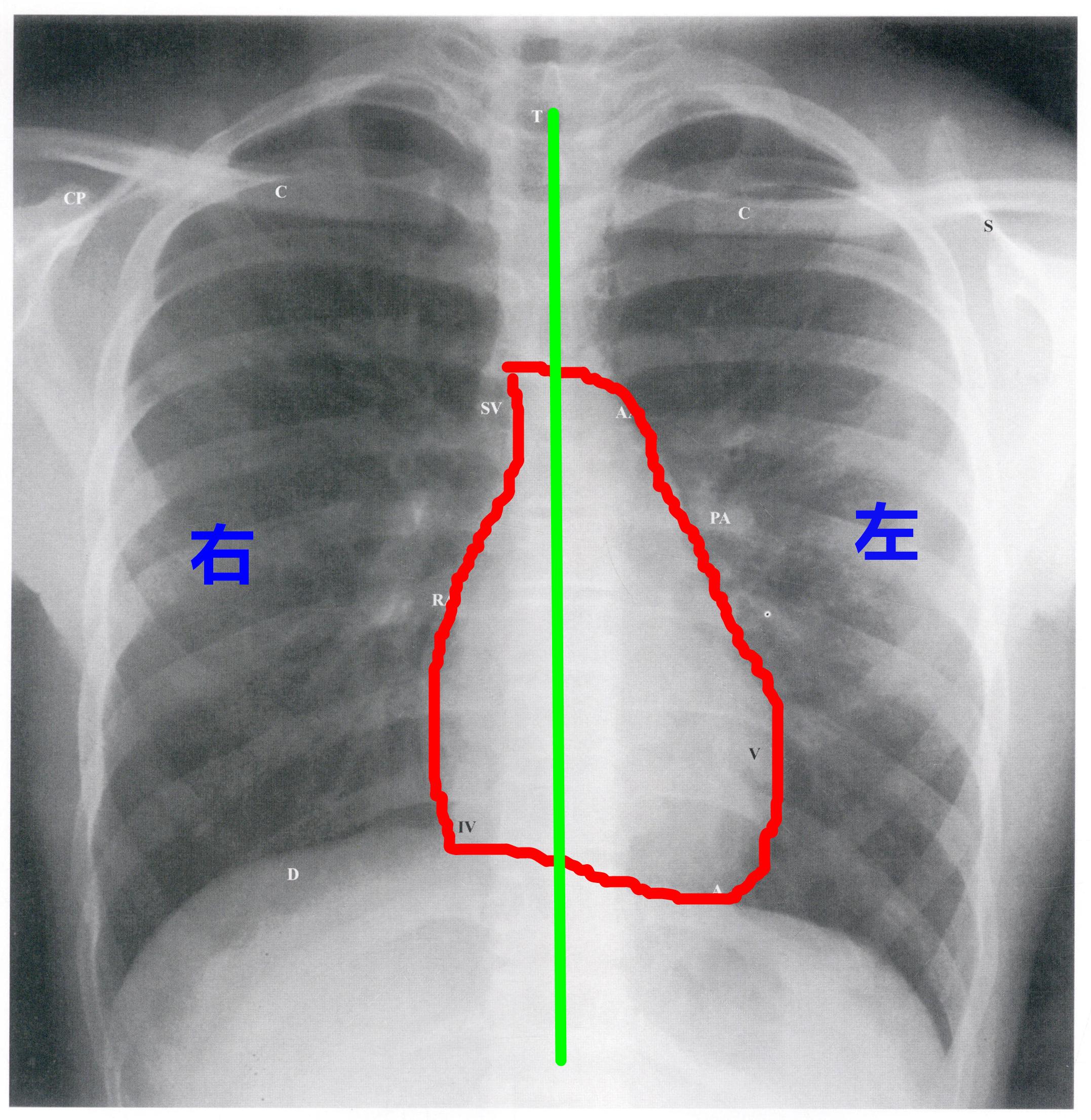 人体胸部肺部心脏器官素材下载