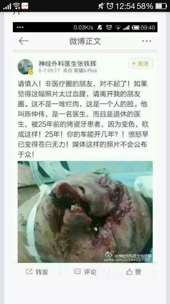 如何看待广东省人民医院口腔科主任被砍事件?