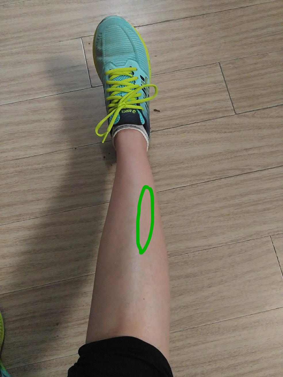 小腿最上面的骨头痛 bf0d888fa47359b20f148888debd7205_r.jpg