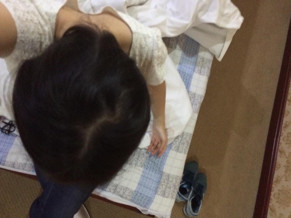 女生头发少会不会秃,有什么办法? - 脱发 - 知乎