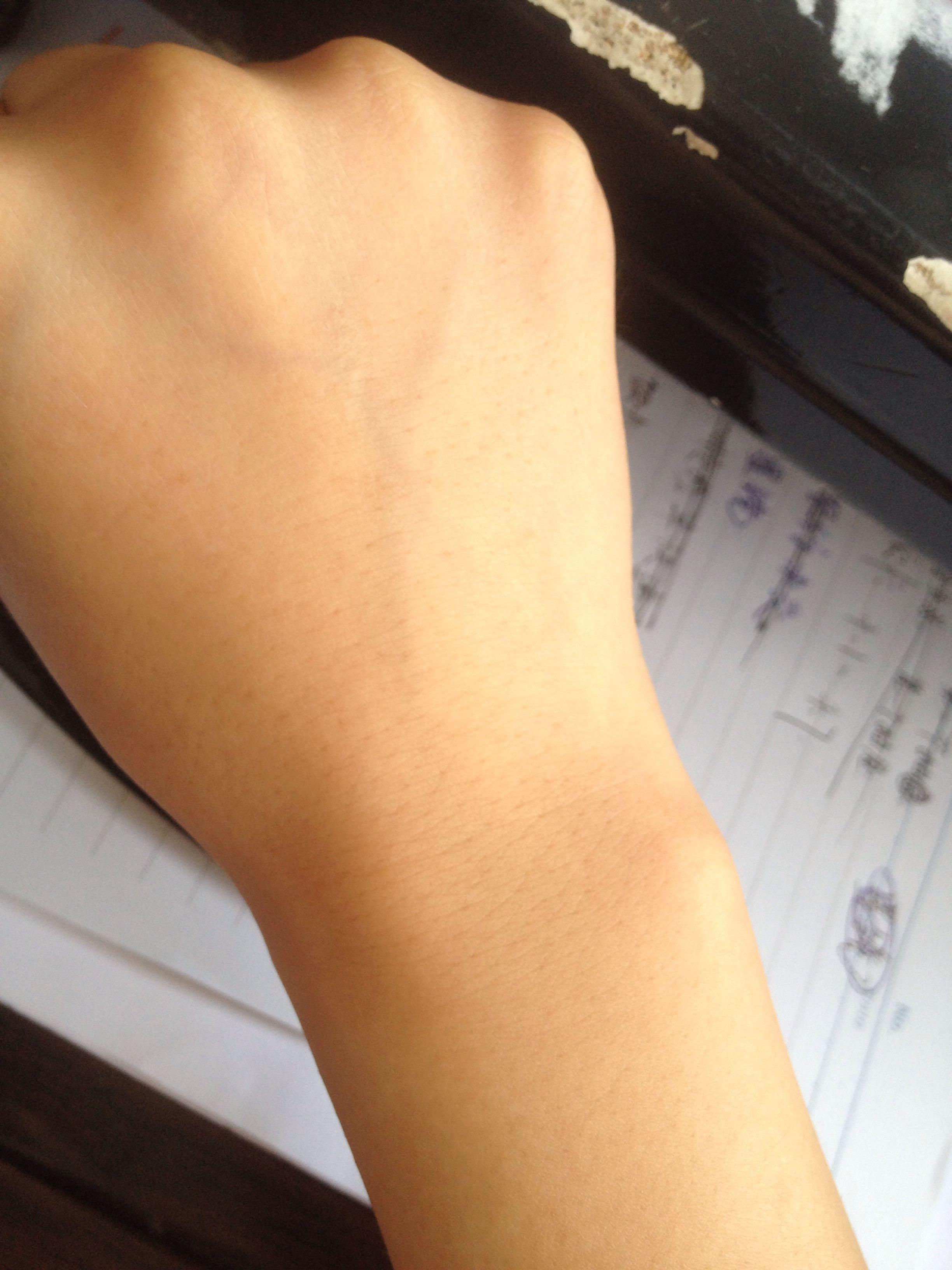 手背毛孔粗大,还有黑点,就是这样的~?