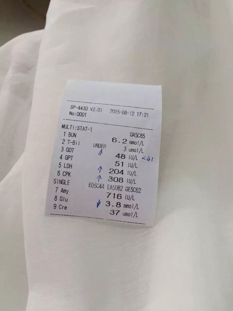 家里养的狗死了,是什么感觉? - 肖肖的回答