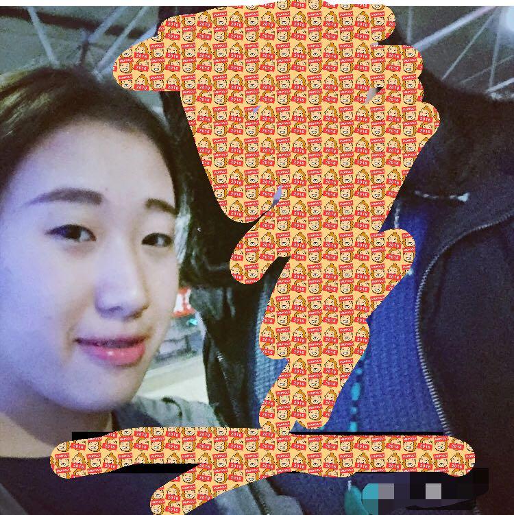 单眼皮 小眼睛的伤 ? - 整容 - 知乎