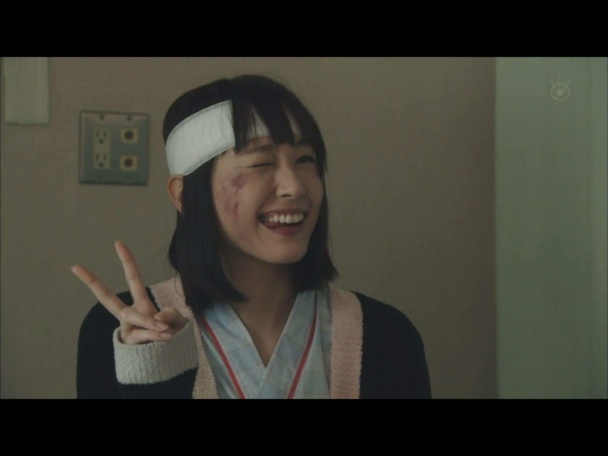 大学生怎么存钱去整容? - 洋哥的回答