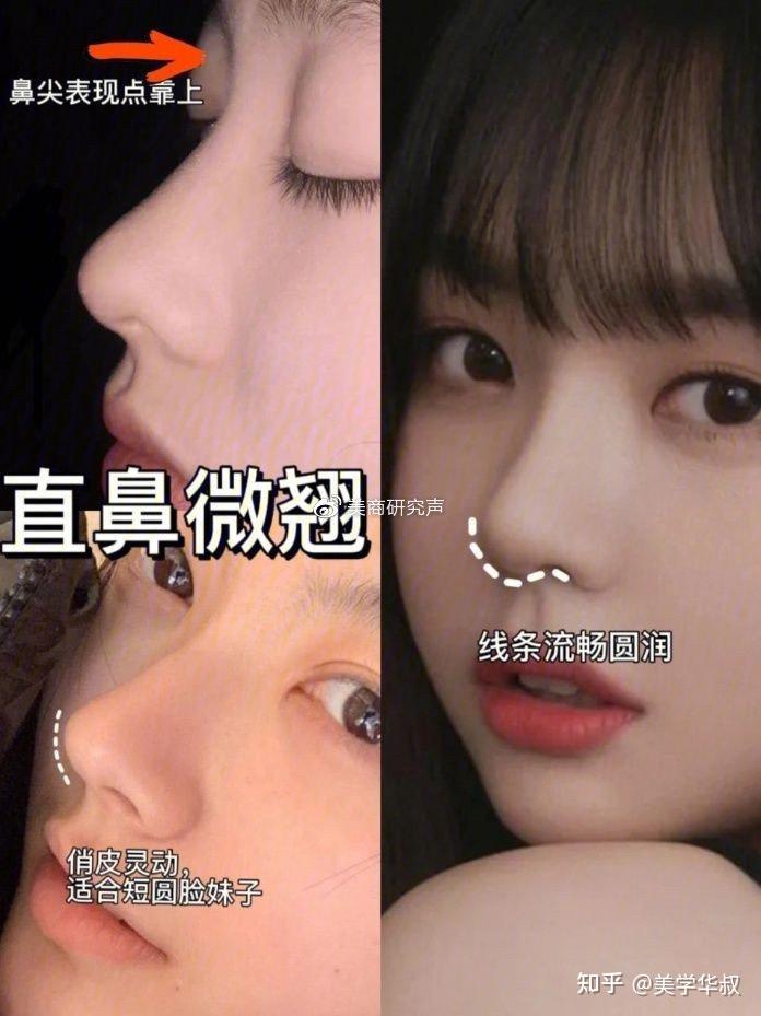 2022隆鼻模板网红鼻小翘鼻怎么选