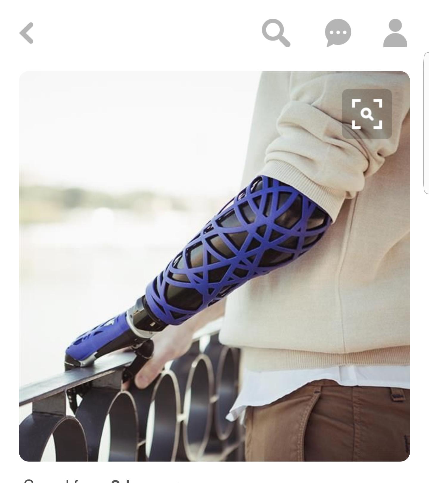 右手先天性残疾可以佩戴假肢么?