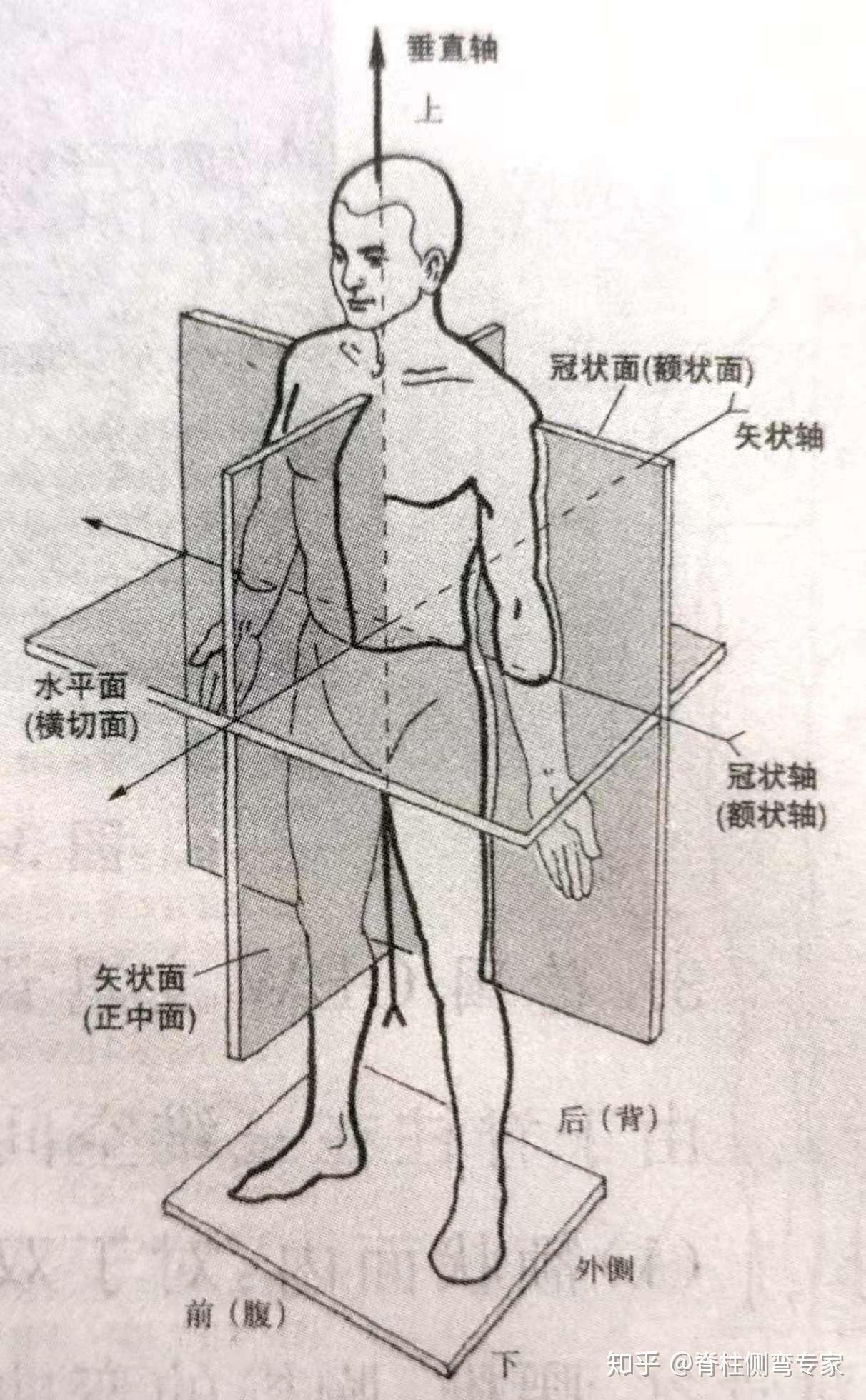 但實際是在三維空間都發生了畸形,也就是在水平面,矢狀面,額狀面都有