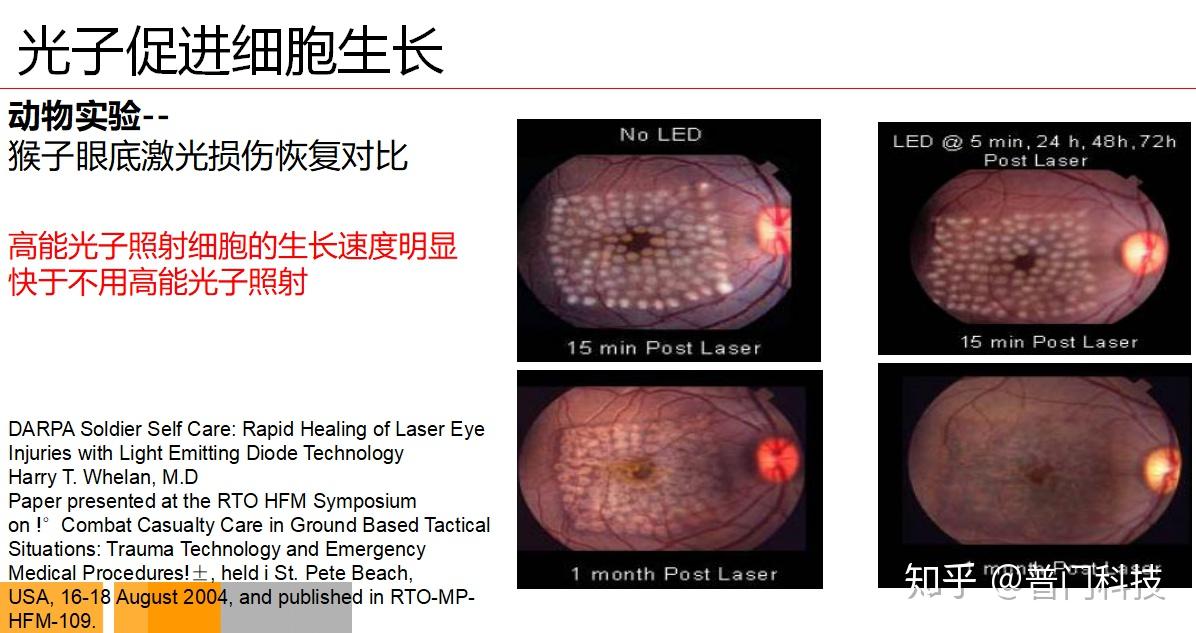 深入了解红蓝光祛痘和治疗痤疮的原理 - 知乎