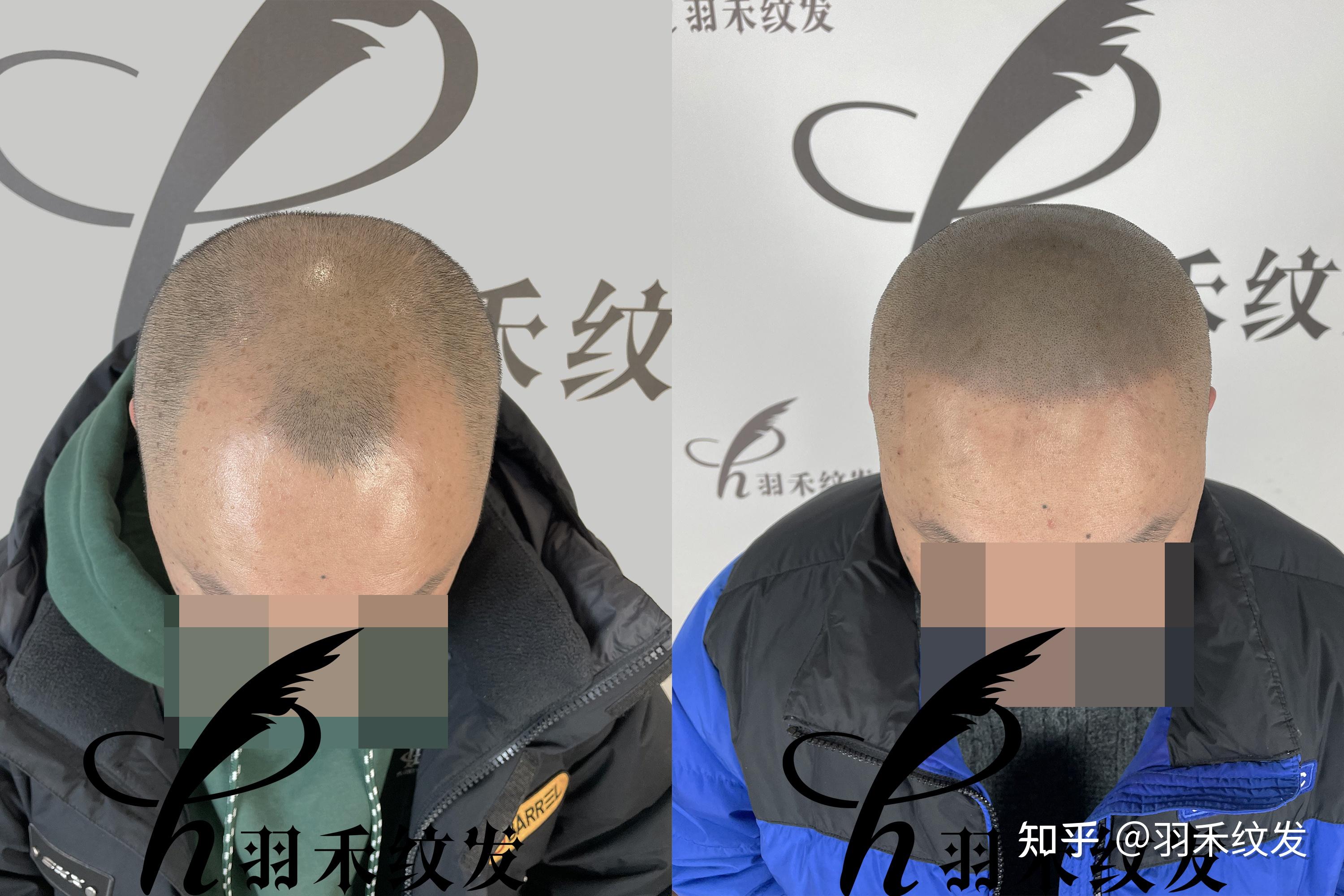 光头做了这一点立马脱离头顶反光的尴尬处境,大家都知道光头头顶遇到