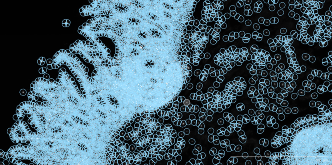 什么，你还没用上Xenium？快来看看最近大热的【Xenium空间原位分析】 - 知乎