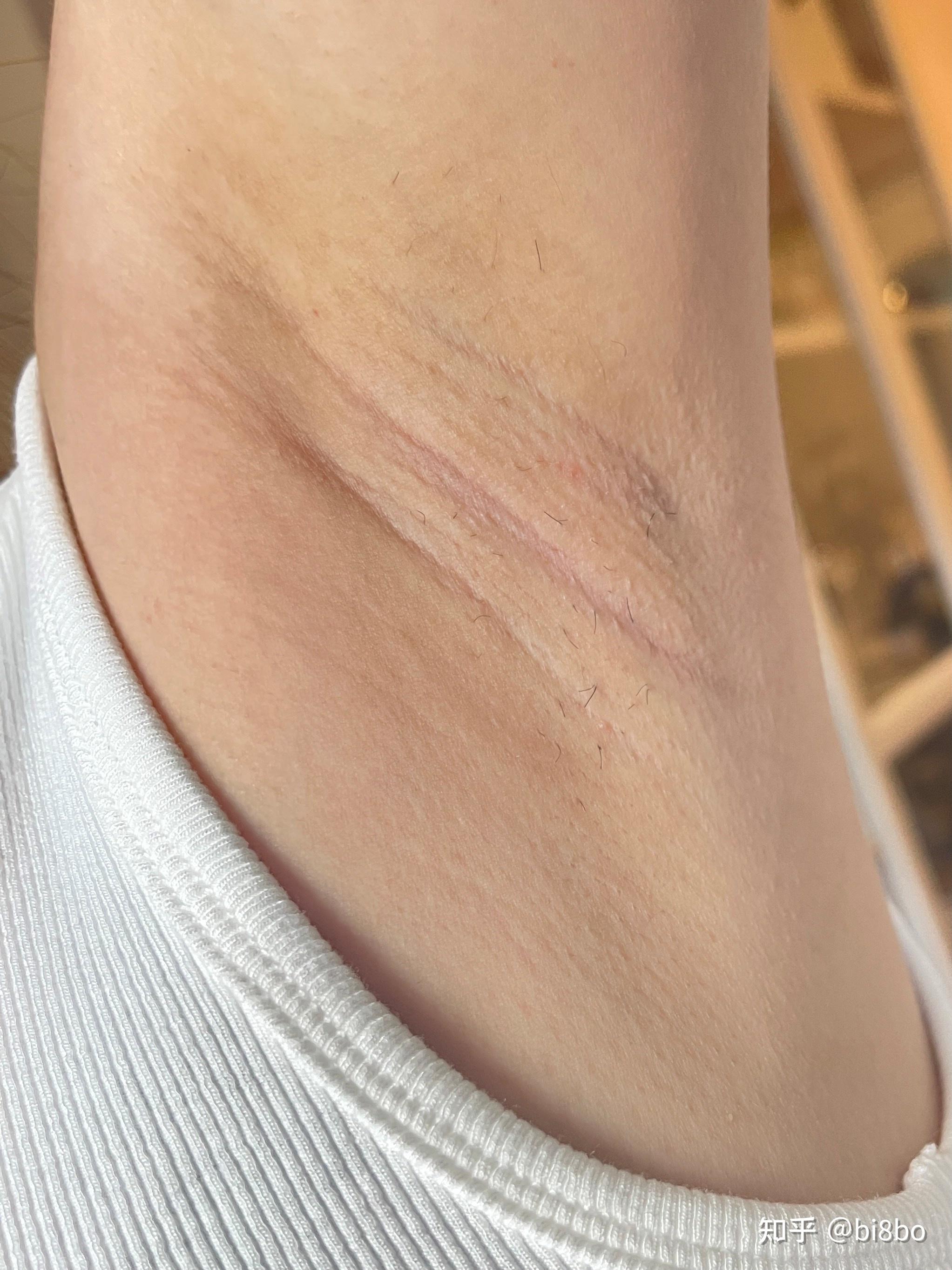 看我用它脱最粗硬顽固的腋毛的效果,基本上前面几周勤快点,一周2,3次