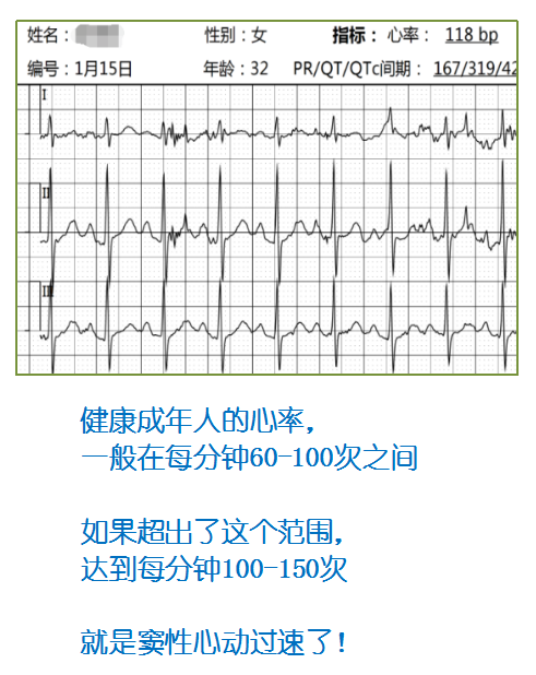 v2-00a900d65207eb2717f0262e001f4318_r.jpg