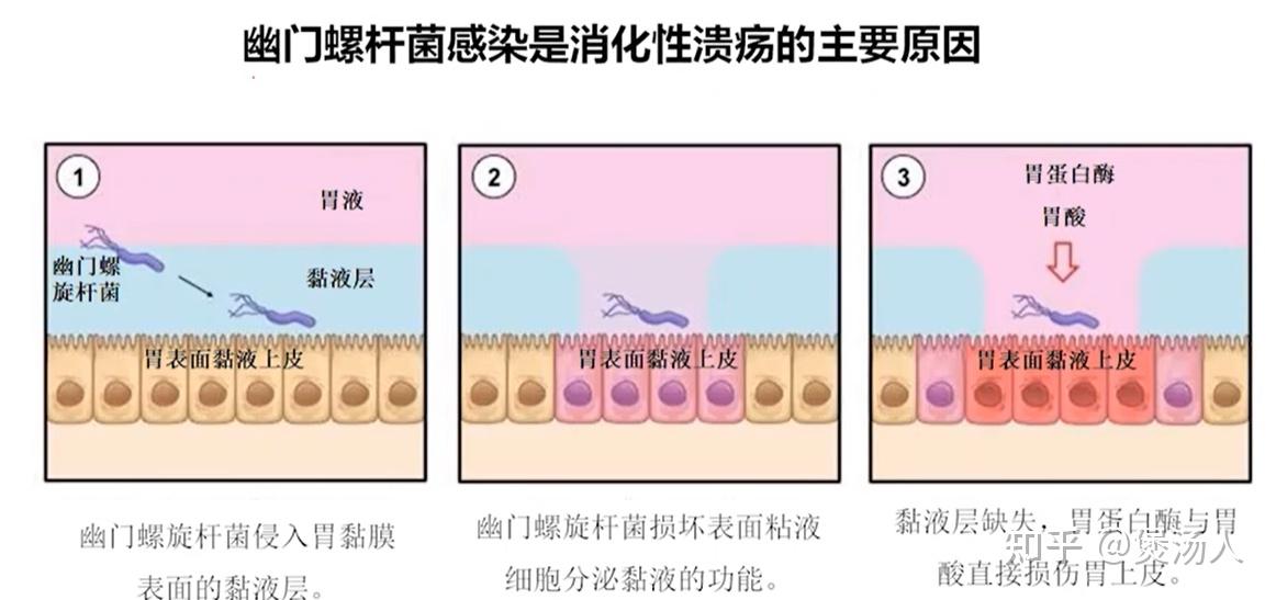 组织胚胎学总结:食管与胃 - 知乎
