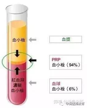 什么是prp美容 效果好吗 知乎