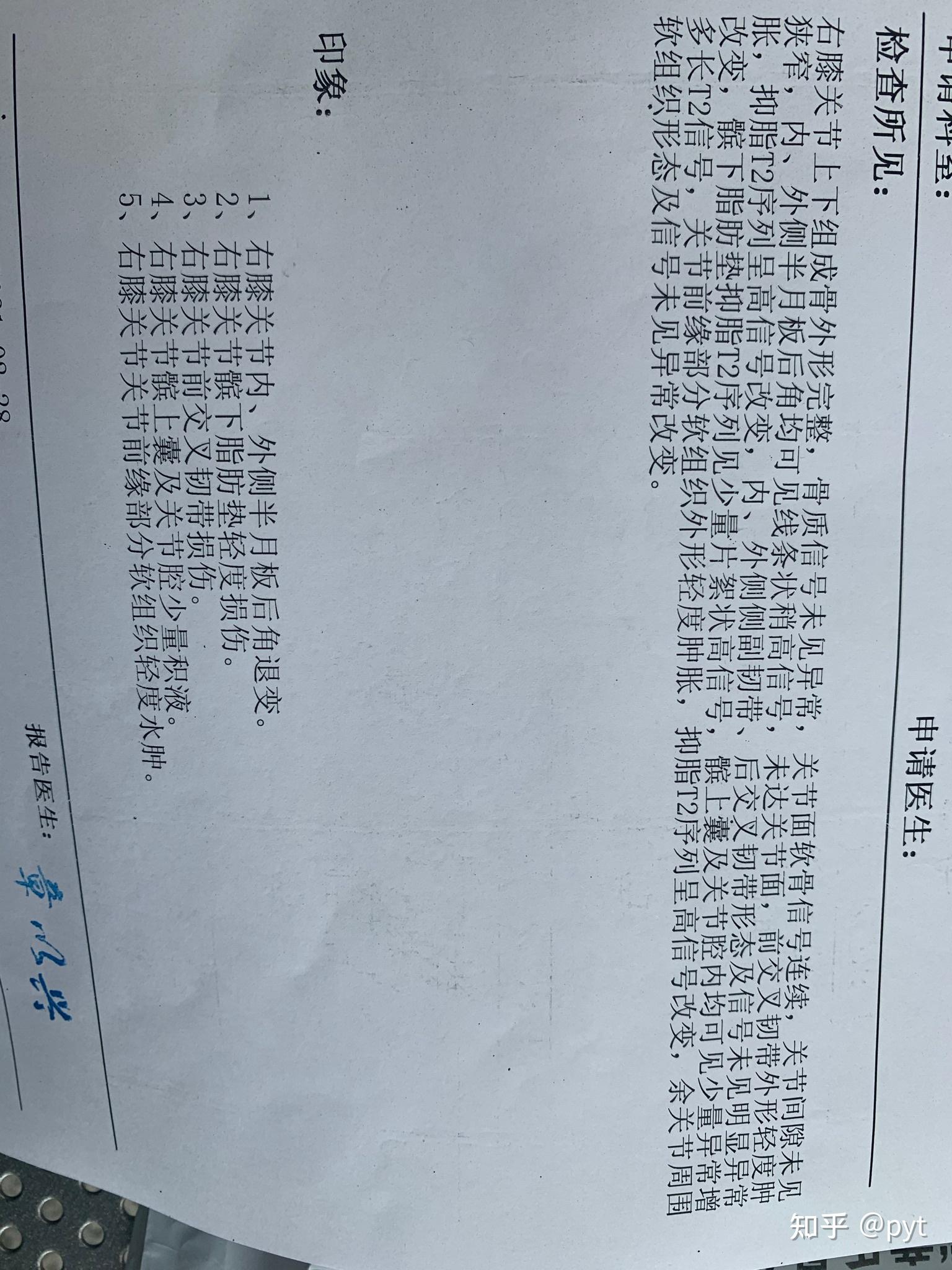 半月板撕裂术后四个月