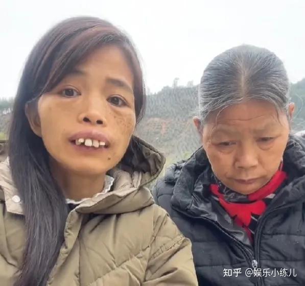 广东女子因长相奇特成大网红一口龅牙无处安放网友抢着要娶她