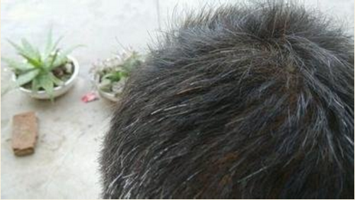 怎么样才能减少头发白 v2-01c716706454b8ff13618808bb527a5d_r.jpg