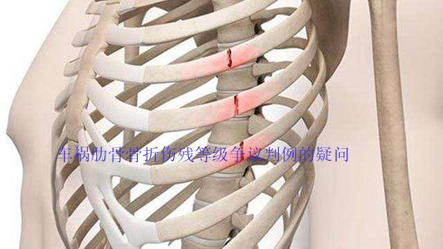 车祸肋骨被撞骨折保险公司怎么赔偿 知乎 车祸肋骨被撞骨折保险公司怎么赔偿 知乎