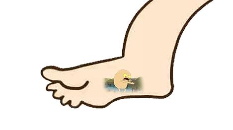 霉菌的生长和繁殖创造良好的环境,久穿之后极易引发俗称"脚气"的足癣