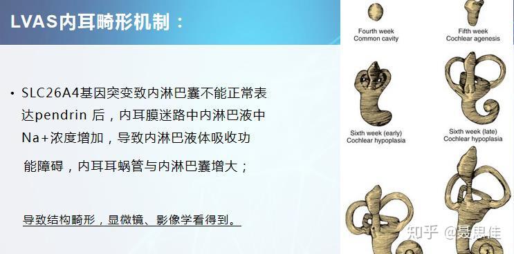 关于大前庭,家长最想知道的问题解答(一) - 知乎