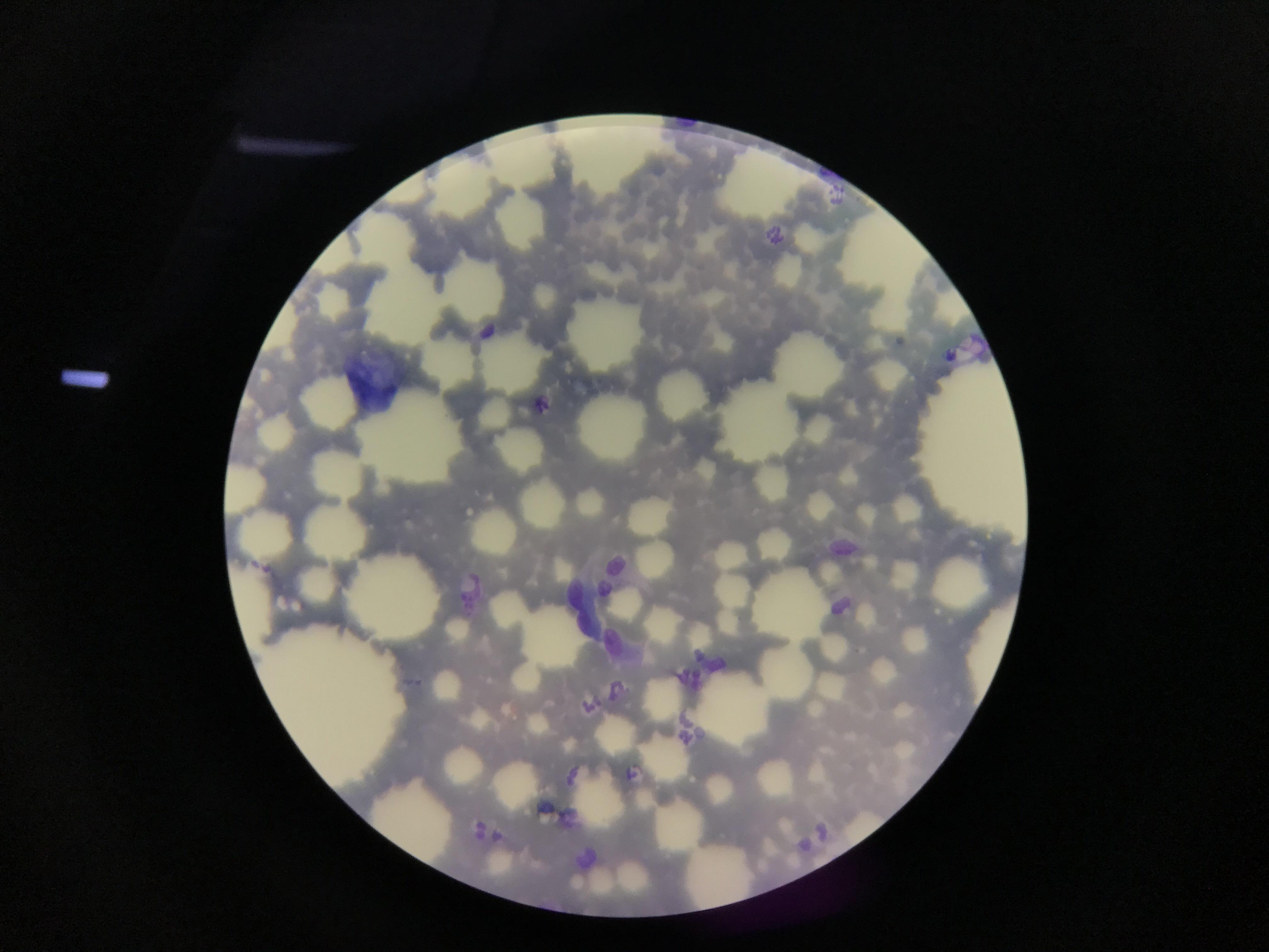 哈哈,纪念一下第一次看到皮肤上的肥大细胞