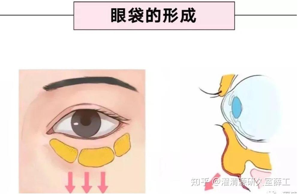 【科普】眼袋的秘密 - 知乎