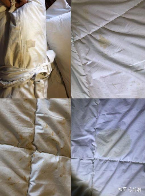 几年时间都情绪消沉,也用过一些牌子的纸尿裤,但不是三天两头湿裤子