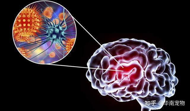 淋巴细胞性脉络丛脑膜炎