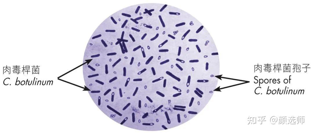 肉毒杆菌形态图片