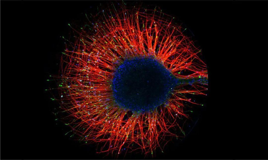 1,光幻视是什么?