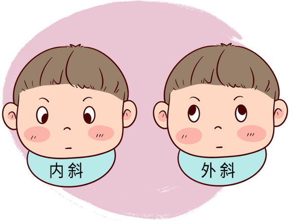 孩子斜视怎么办？听眼科专家咋说！ - 知乎