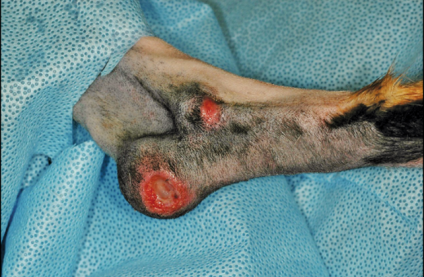 【软组织外科学】 肘部水囊瘤的保护装置