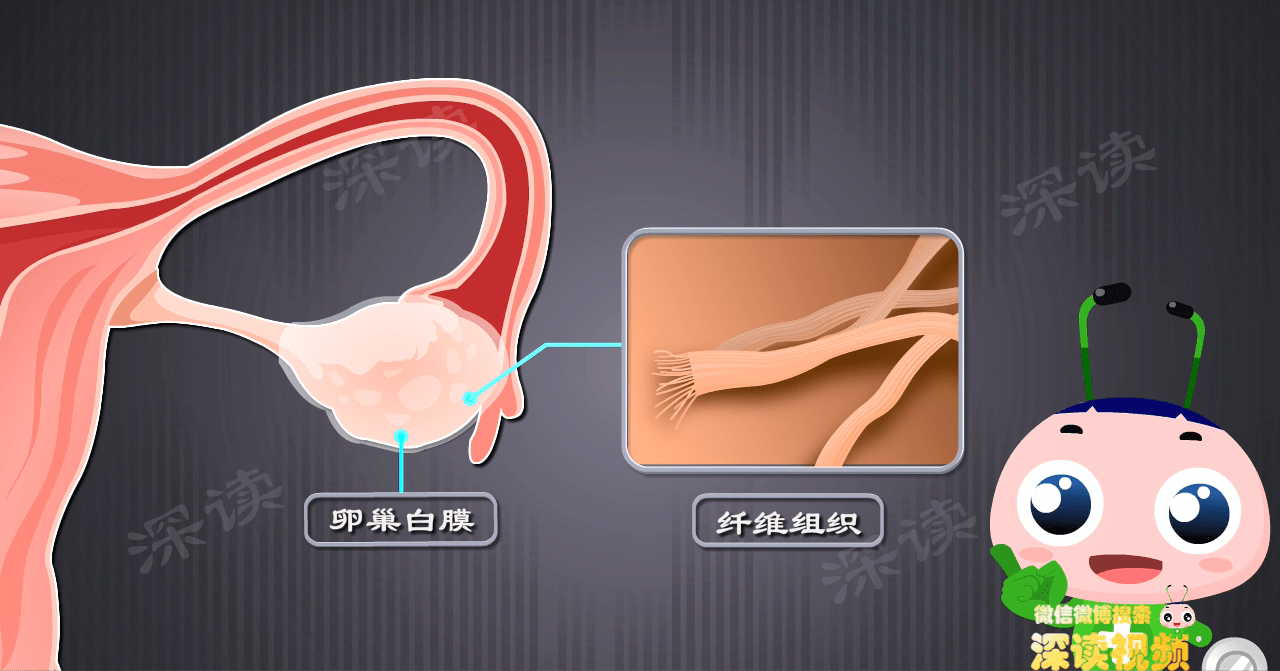 切開卵巢,裡面都是密密麻麻的小