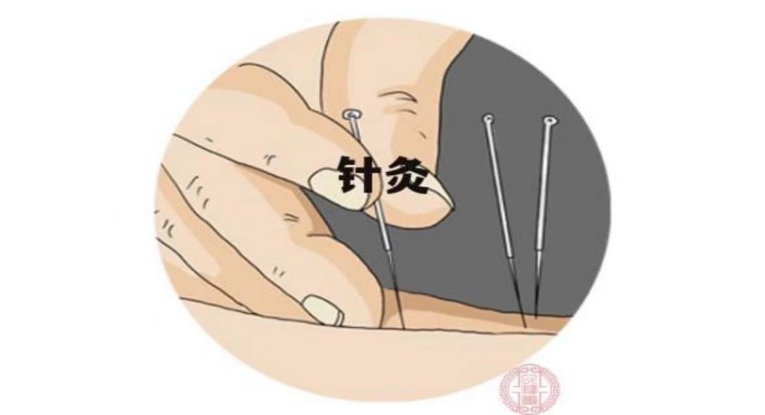 健康科普| 针灸治疗失眠有奇效 - 知乎