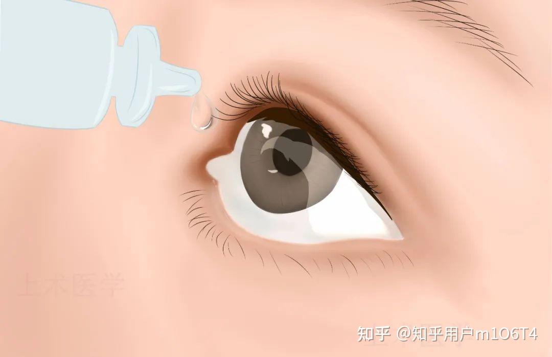散瞳是什么 zhuanlan.zhihu.com