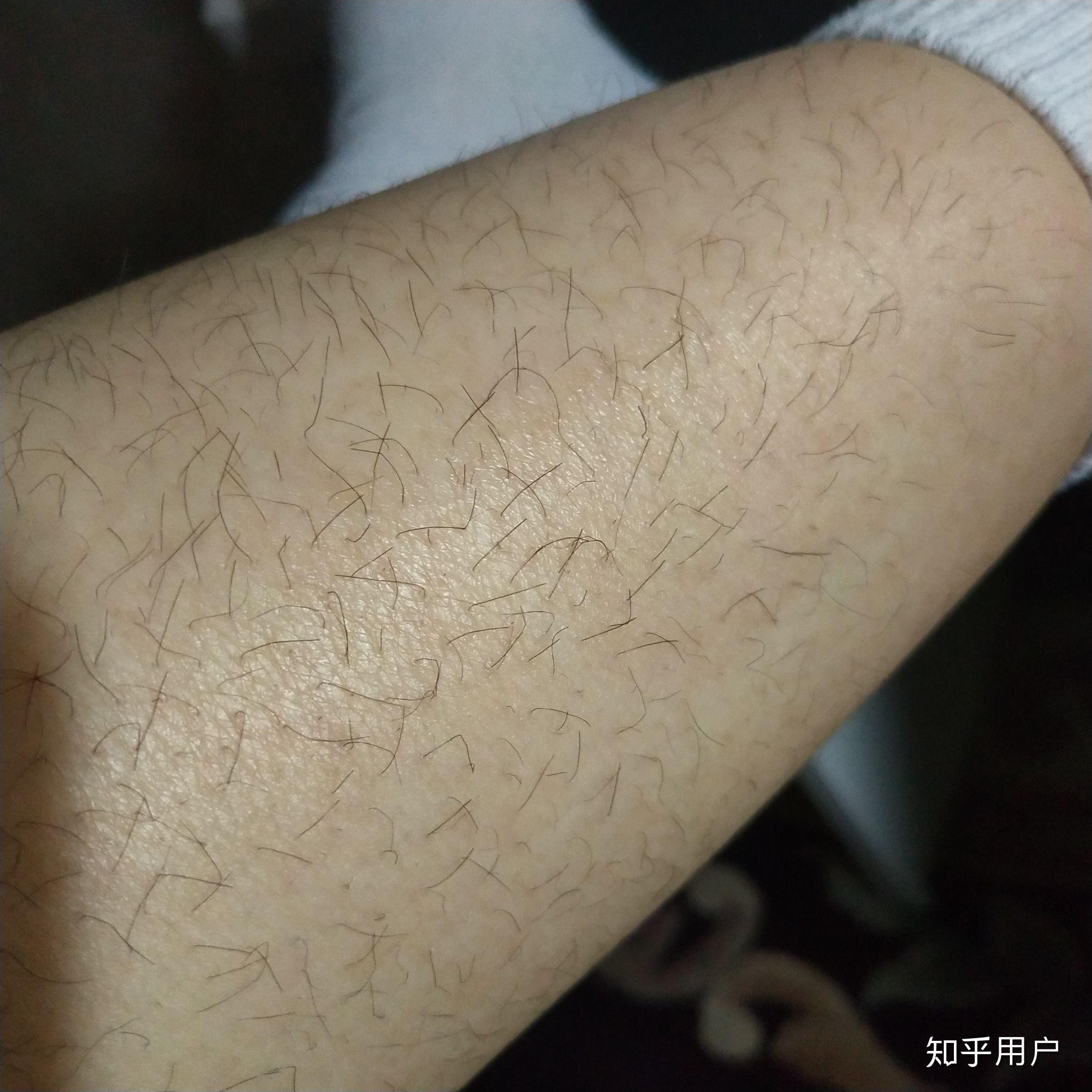 女生腿毛旺盛是怎样的人生体验? - 知乎
