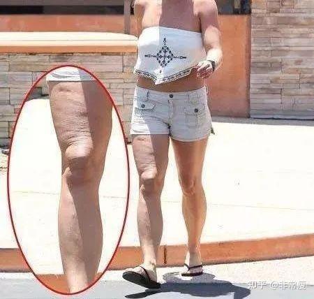 你却丑成典型案例特别是30岁后,代谢越来越慢,皮肤松弛下垂,赘肉顽固